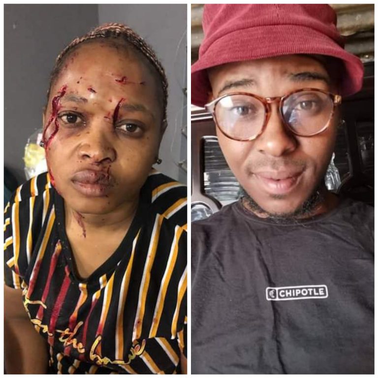 “Welcome to South Africa where you can do this to a woman and get a R500 bail” – Lady reacts as court grants bail to her baby daddy who allegedly attacked her with bottle