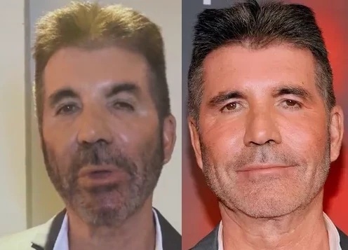 Simon Cowell trolled as his new looks sparks concern (video)