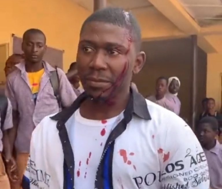 Corps member bleeds from the head after being attacked by students at the secondary school he was posted to in Osun State