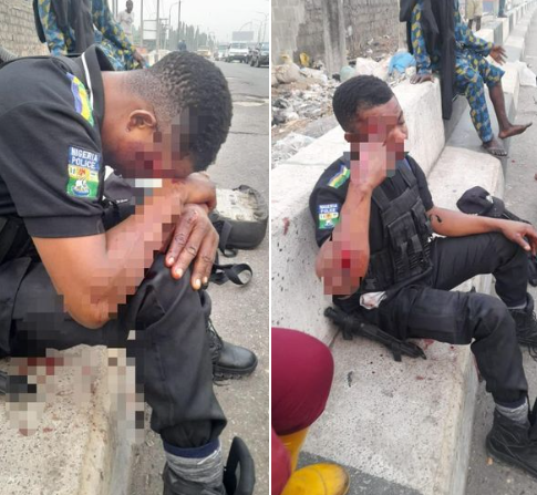 Hit-and-run driver injures policeman in Lagos