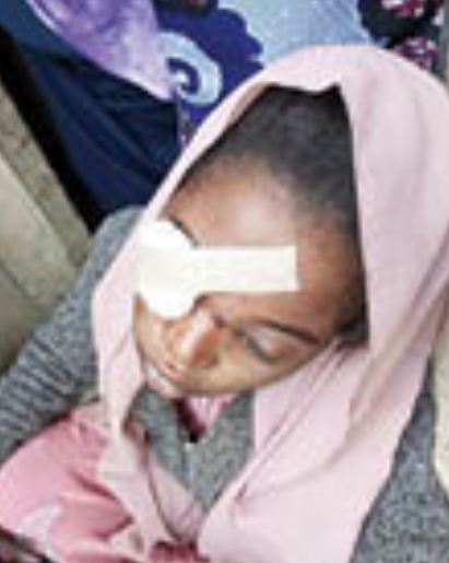 Bride suffers injury in her eye after vigilante members allegedly disrupted her wedding party in Kano