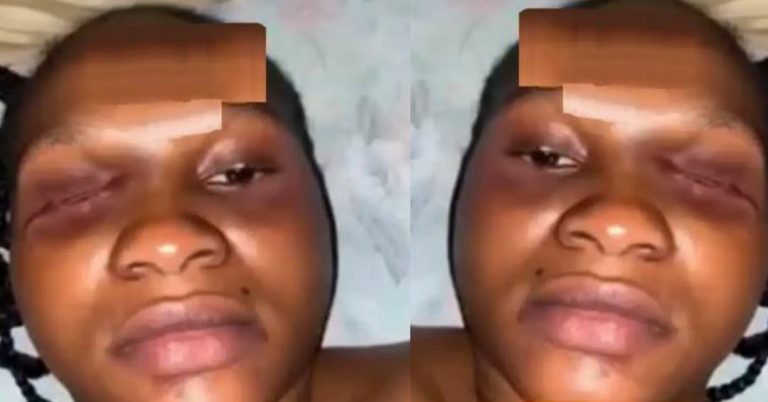 “If your relationship is toxic please leave, don’t wait till it reaches this stage” —Lady uses experience to advise people (Video)