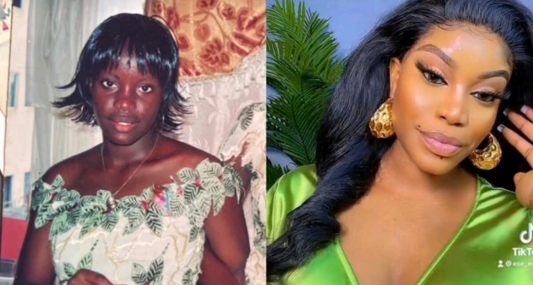 ‘Thank God for bleaching cream, so you were actually a black skinned girl’ – Fans react after Ese Eriata shared before and after photos