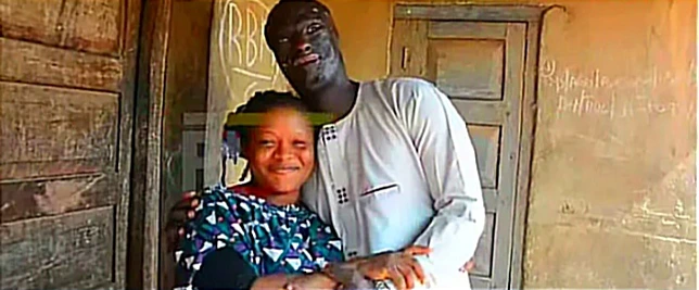 “He makes me happy everyday and he gives me peace of mind” – Woman reveals why she married man with a disfigured face