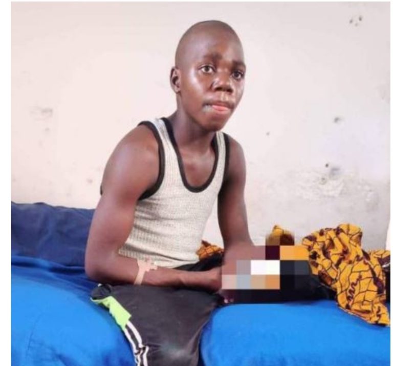 19-year-old boy recounts his ordeal as bandits cut off his arm despite paying ransom