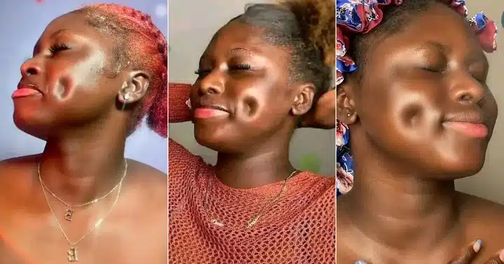 “It is not fake” – Nigerian lady breaks internet after sharing photos of her deep facial dimples