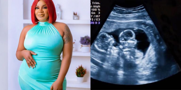 “This is one of my most challenging journeys so far” – Destiny Etiko, Nkechi Blessing, others react as Uche Ogbodo reveals she’s expecting twins