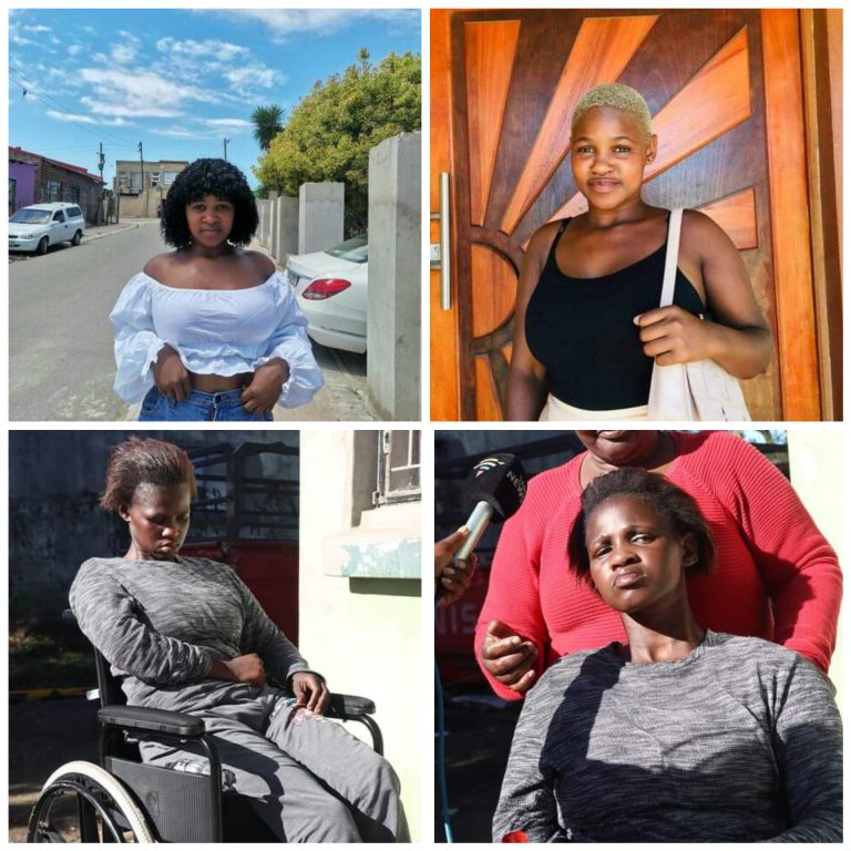 Photos of 23-year-old South African woman left paralysed and brain damaged after brutal attack by her boyfriend’s rival