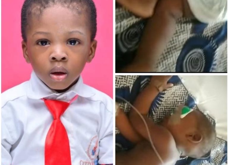 NDLEA launches investigation into stray-bullet incident that claimed the life of 2-year-old boy and left his brother with an eye injury