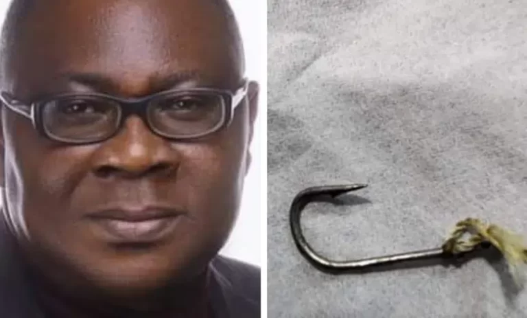 “Very scary” – Nigerian man narrates how he almost swallowed a metal hook in soup while eating at funeral