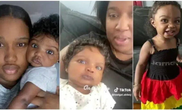 “She is not a doll; she’s my baby” – Mother of unique-looking child addresses ill-comments