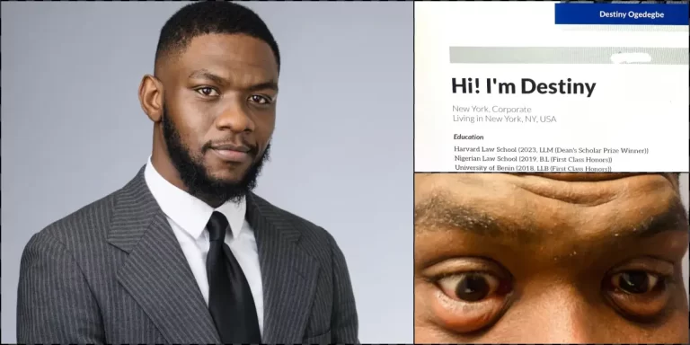 “I passed, became a finance lawyer at a Wall Street firm in New York” – Man celebrates, shares condition of eyes after studying 13 hours daily for bar exams