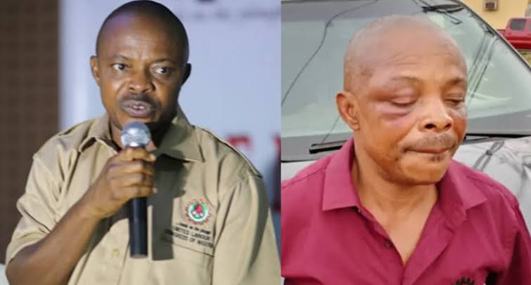 I have no reason to encourage or support an assault on Joe Ajaero, he is pursuing his personal interest – Uzodinma