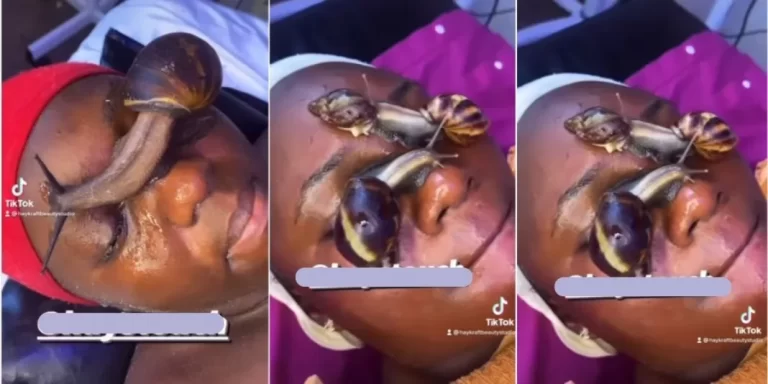 “Which kind of therapy is this?” – Video of live snails crawling on lady’s face sparks outrage (Watch)