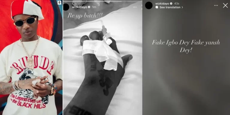 Fake Igbo dey, fake yansh dey – Singer Wizkid says as he lands in hospital