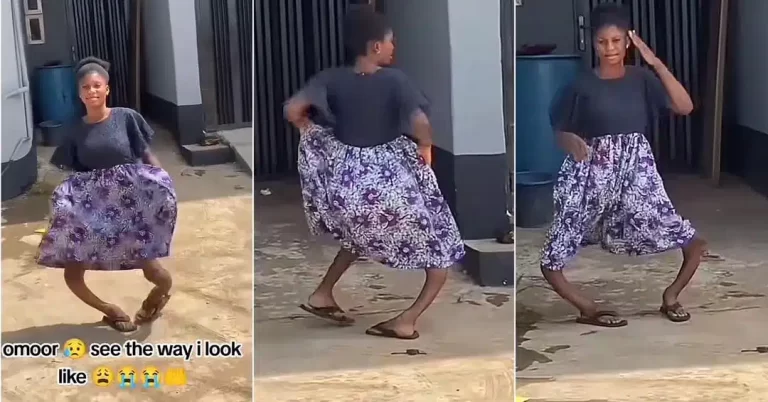 “See the way I look” – Nigerian lady cries out over the shape of her legs (Video)