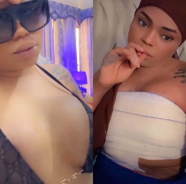 Bobrisky shows off the result of his new breast surgery