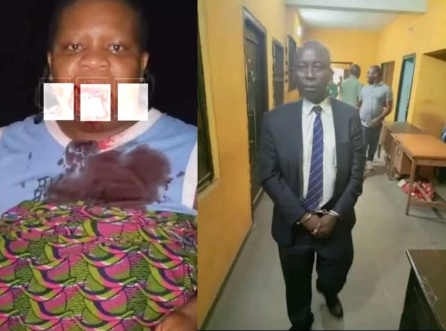 “The crime committed by her husband is a crime against the state” -Akwaibom Lawyer who assaulted wife in viral video could still be prosecuted despite the woman withdrawing the case