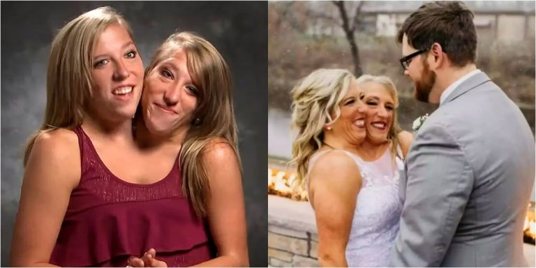 “True love still exists” – Reaction as Conjoined Twin Abby Hensel is happily married to a U.S. Army veteran (Video)