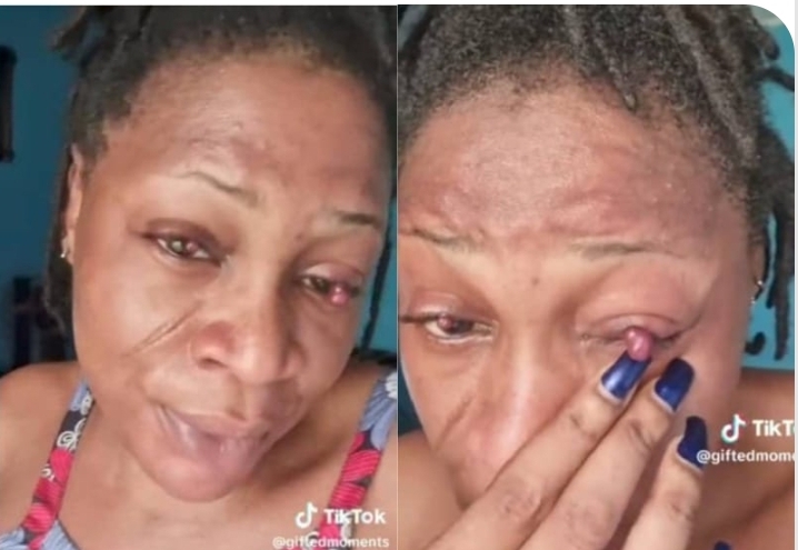 “It’s becoming scary” – Lady shares how pregnancy affected her eyes