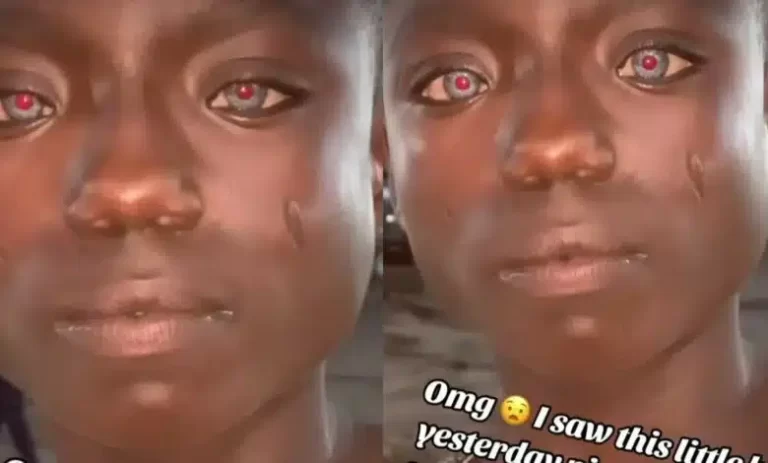 “I saw this little boy yesterday night with blue and red eyes” – Nigerian lady says, shares unique video of little boy