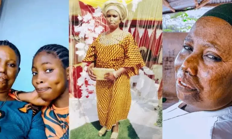 “My stepmom poured acid on her” – Nigerian lady explains as she flaunts beautiful appearance of mother on social media