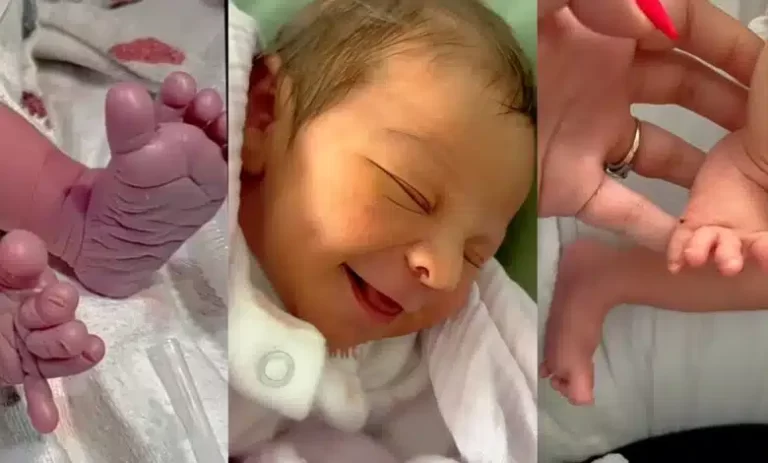 Video trends as baby’s unusually shaped leg gets amputated, replaced with prosthetic