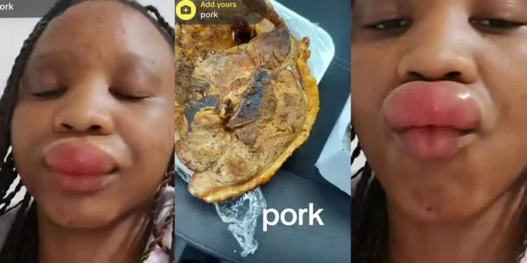 “I was allergic to pork” – Nigerian woman develops allergy after eating pork, shares shocking video on social media