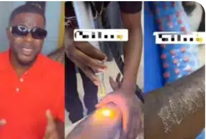 Man erases lover’s name permanent tattoo after messy breakup (Video)