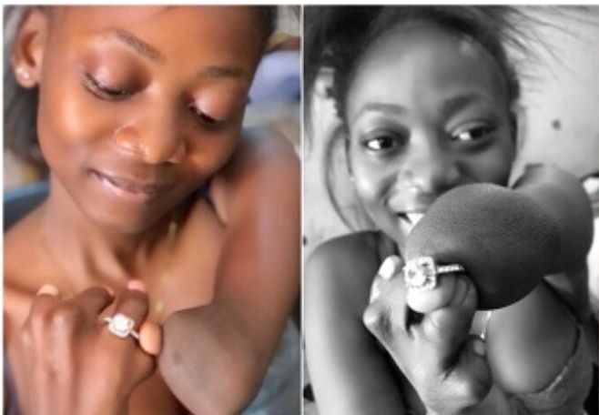 “It’s a YES” – Amputee over the moon as boyfriend proposes to her, flaunts ring online