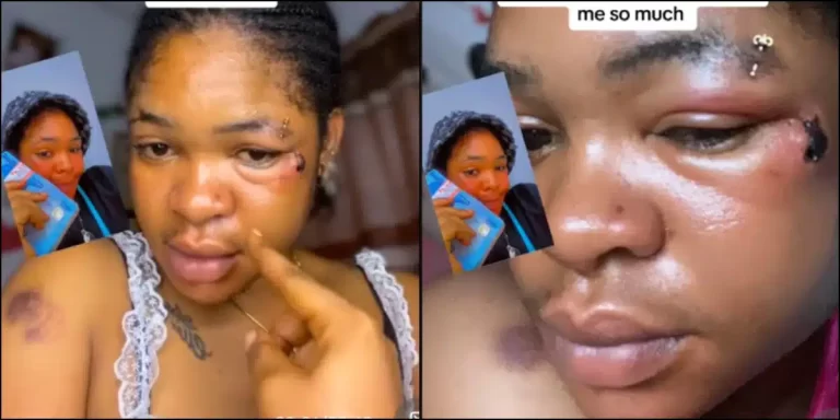 Lady shares what boyfriend did to her face after she requested N150K for wig