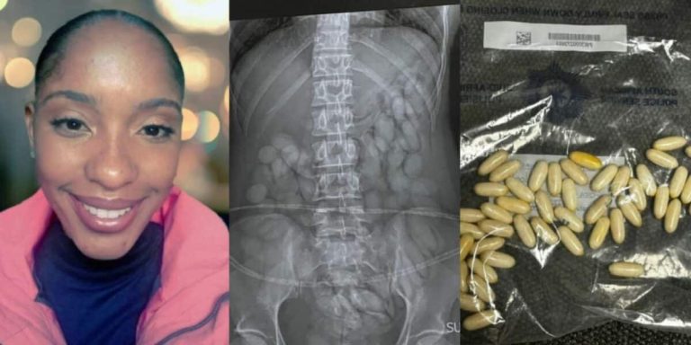 Drugs found in the stomach of Namibian woman returning from Brazil with Nigerian lover